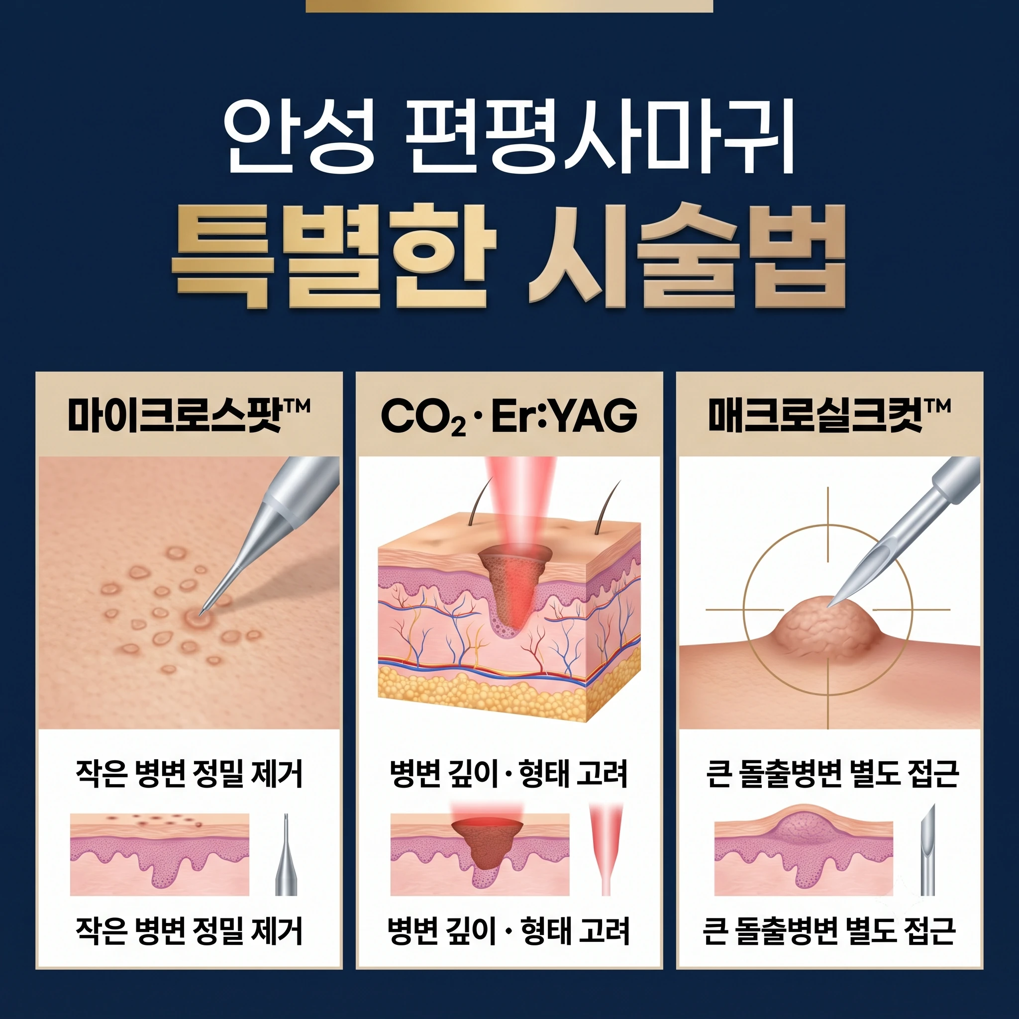 안성 편평사마귀 특별한 시술법