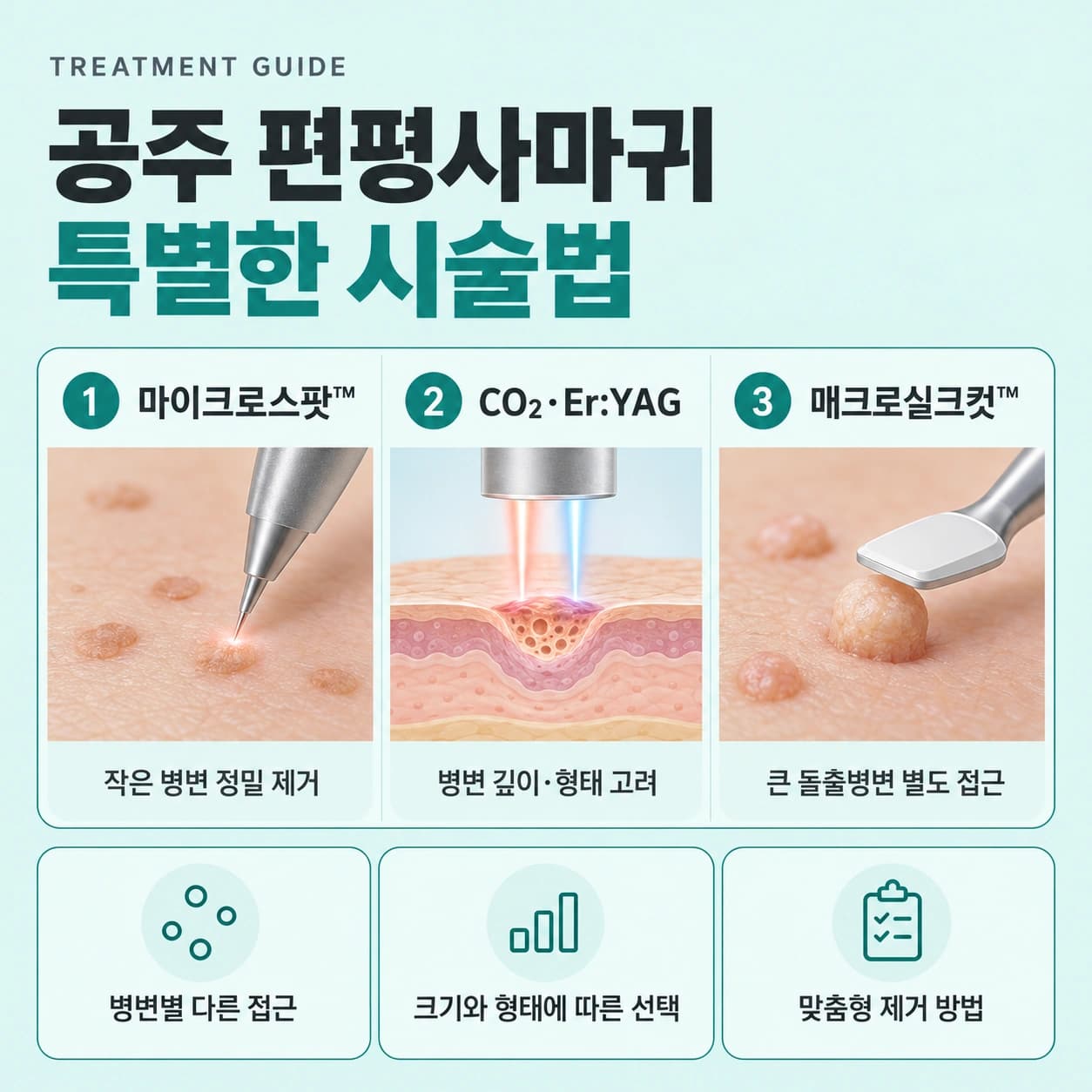공주 편평사마귀 특별한 시술법