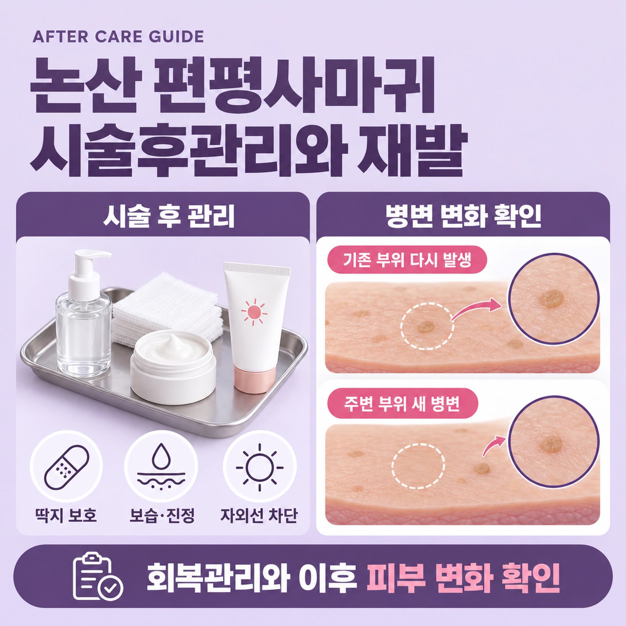 논산 편평사마귀 시술후관리와 재발