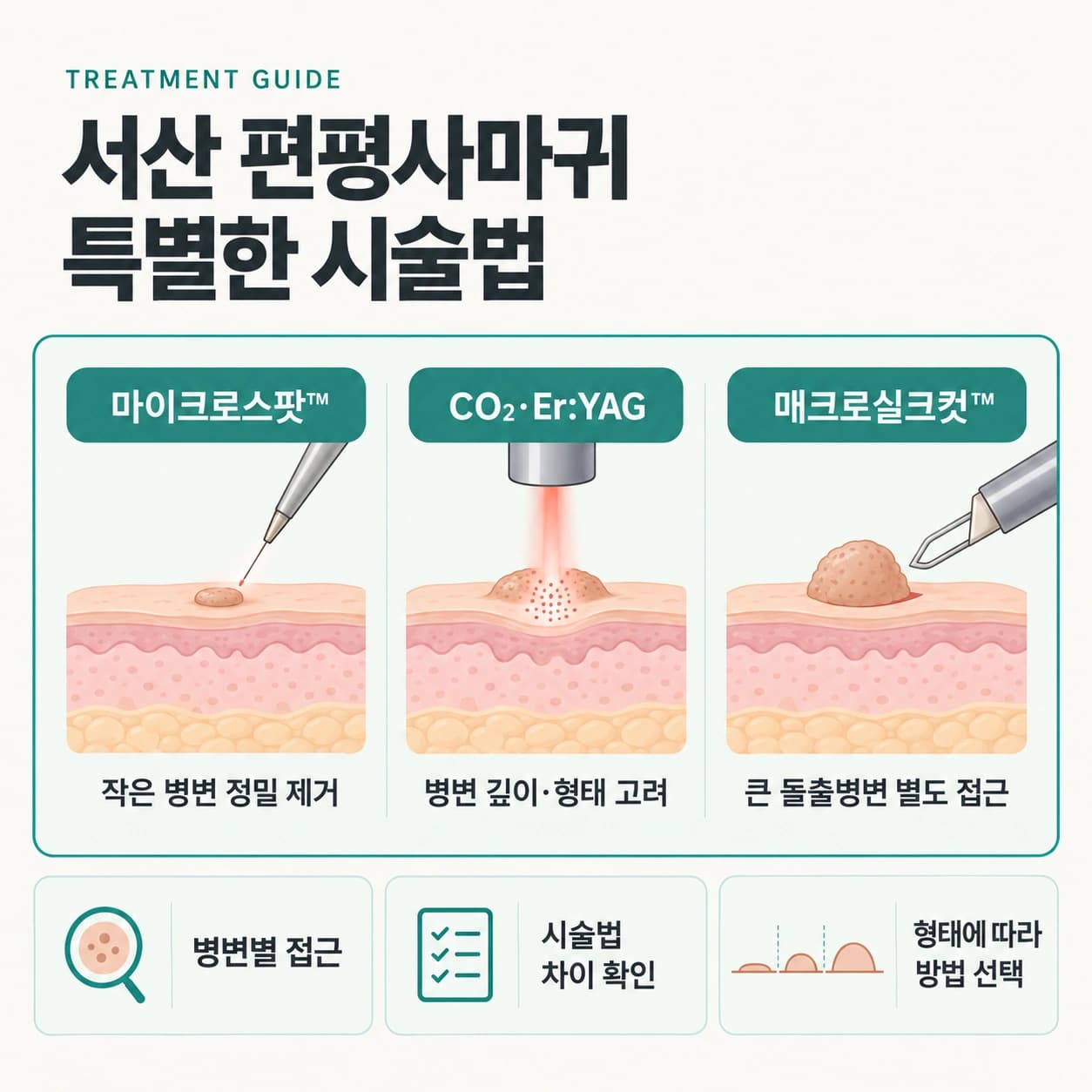 서산 편평사마귀 특별한 시술법