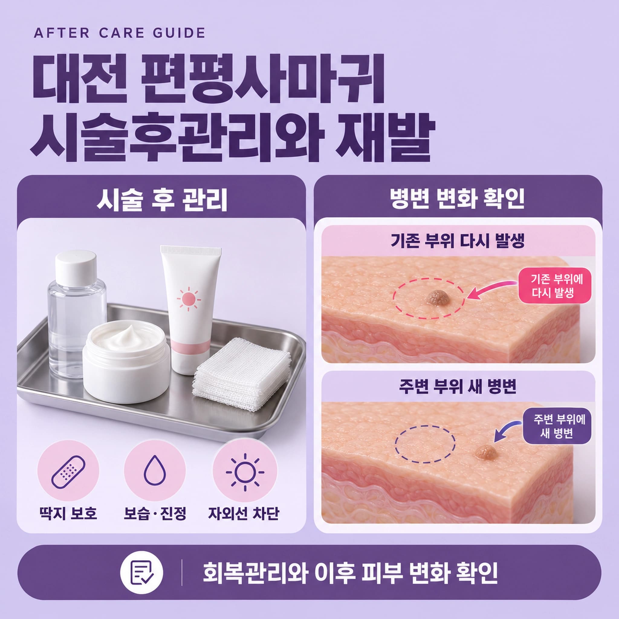 대전 편평사마귀 시술후관리와 재발