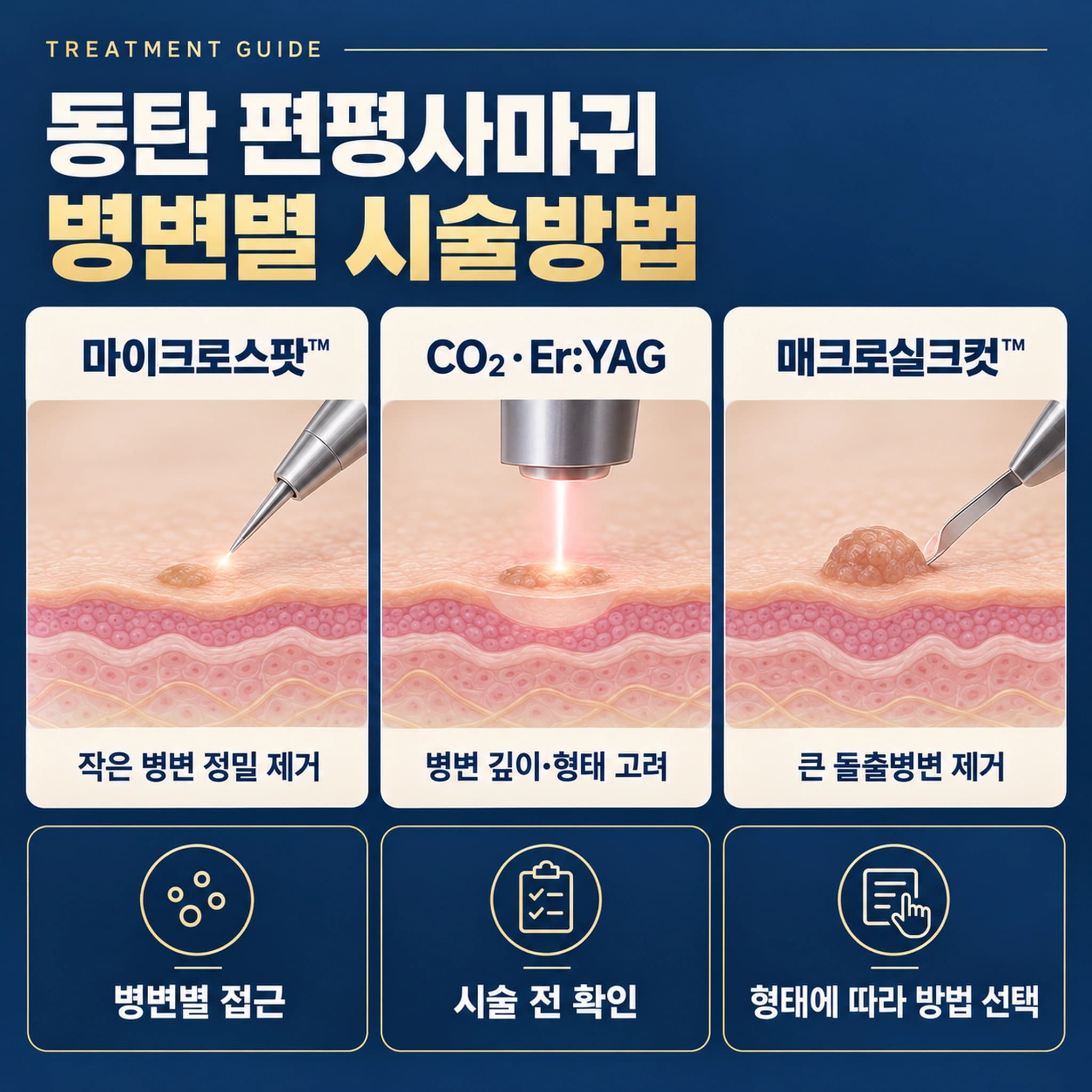 동탄 편평사마귀 특별한 시술법