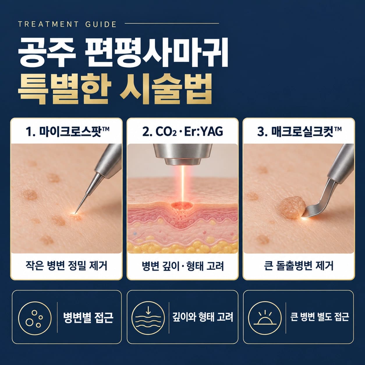 공주 편평사마귀 특별한 시술법