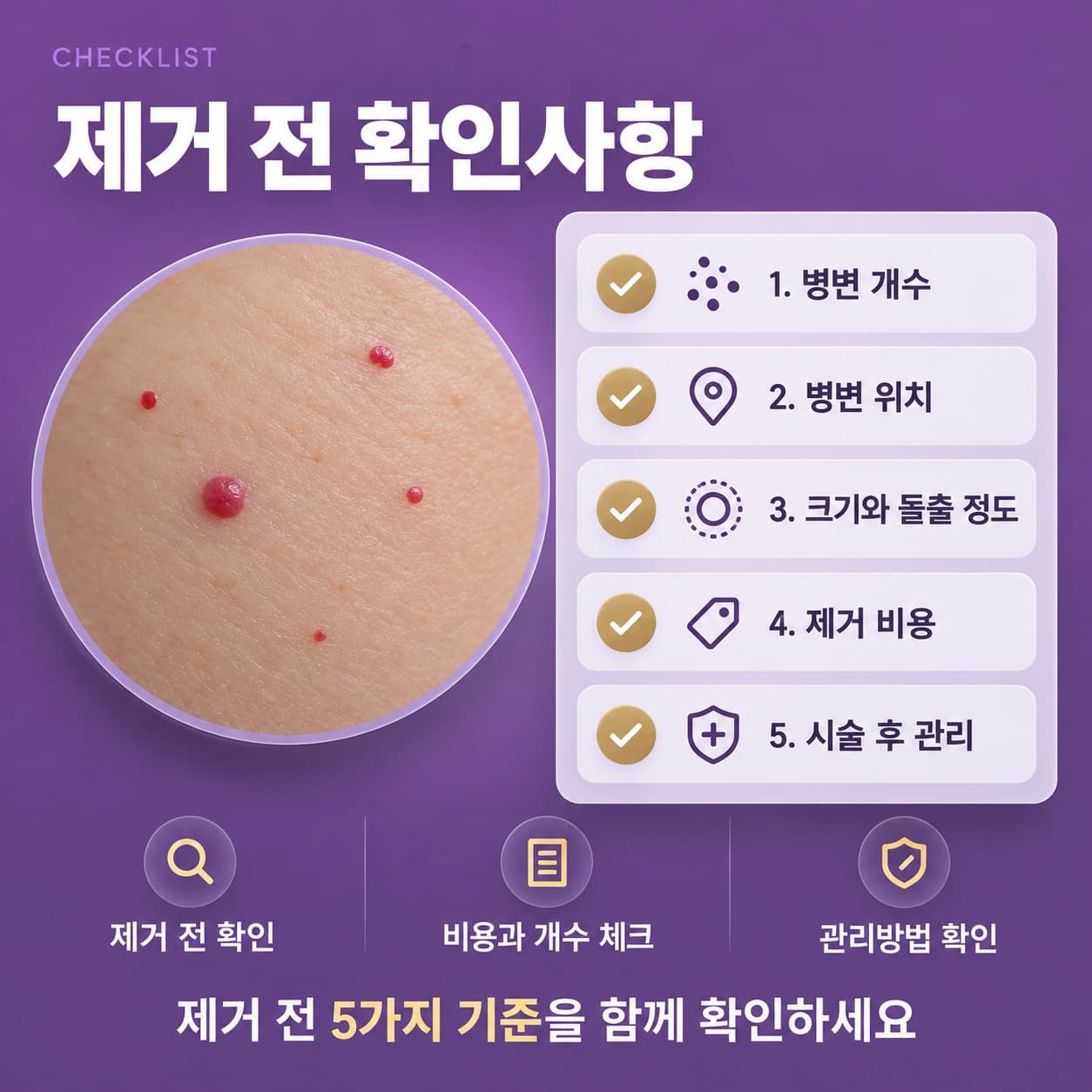 천안 체리혈관종 제거 확인할 사항