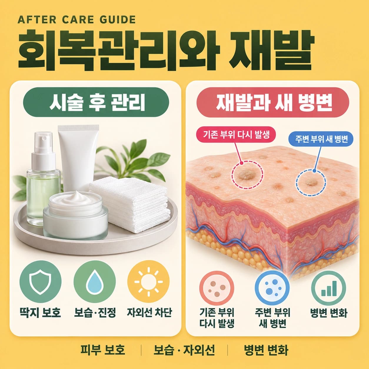 천안 편평사마귀 시술후 관리와 재발