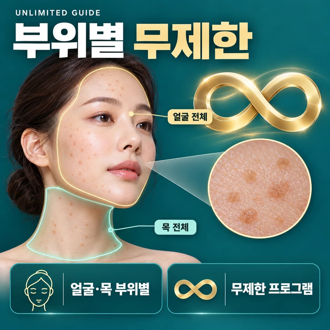 천안 편평사마귀 무제한