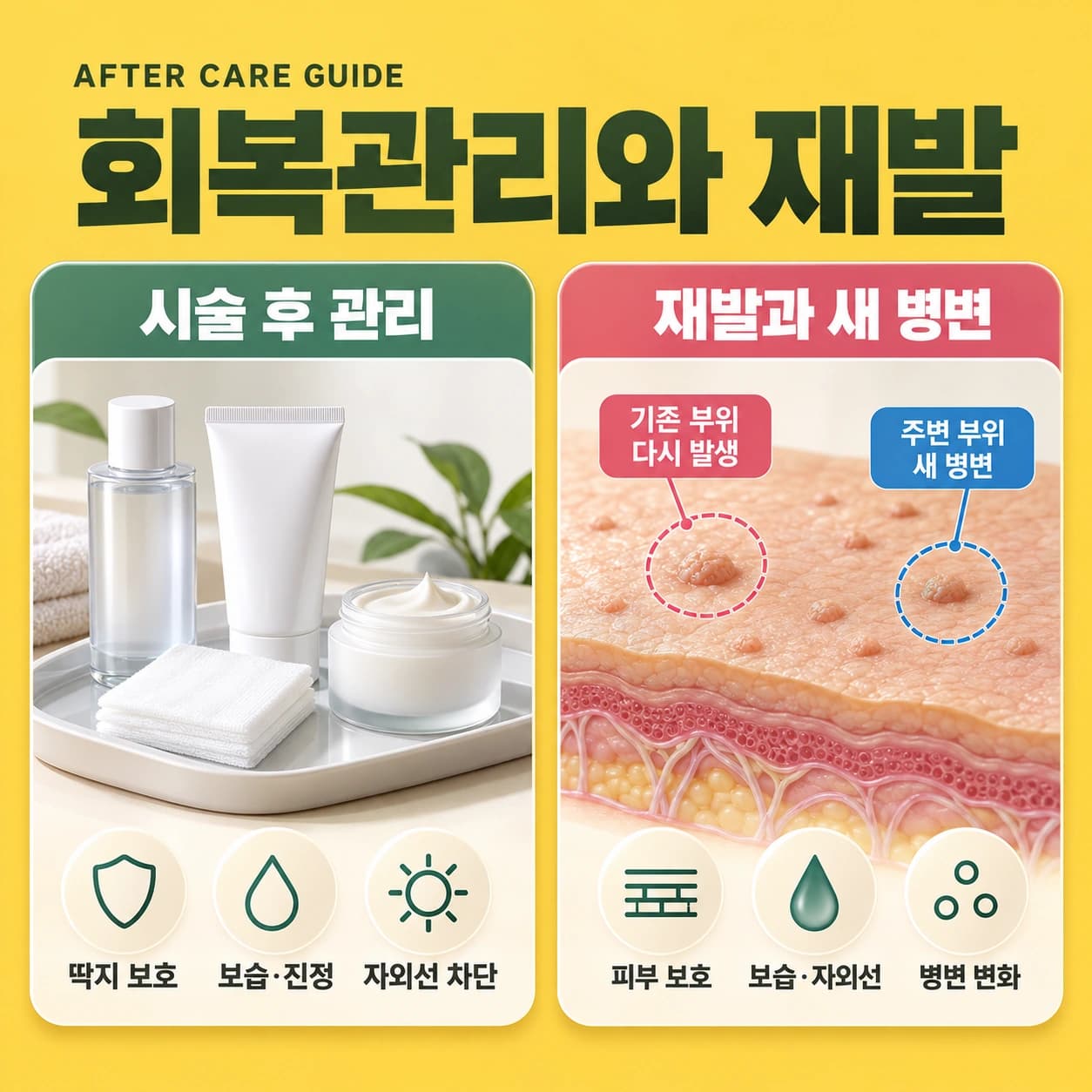 천안 편평사마귀 시술후 관리와 재발