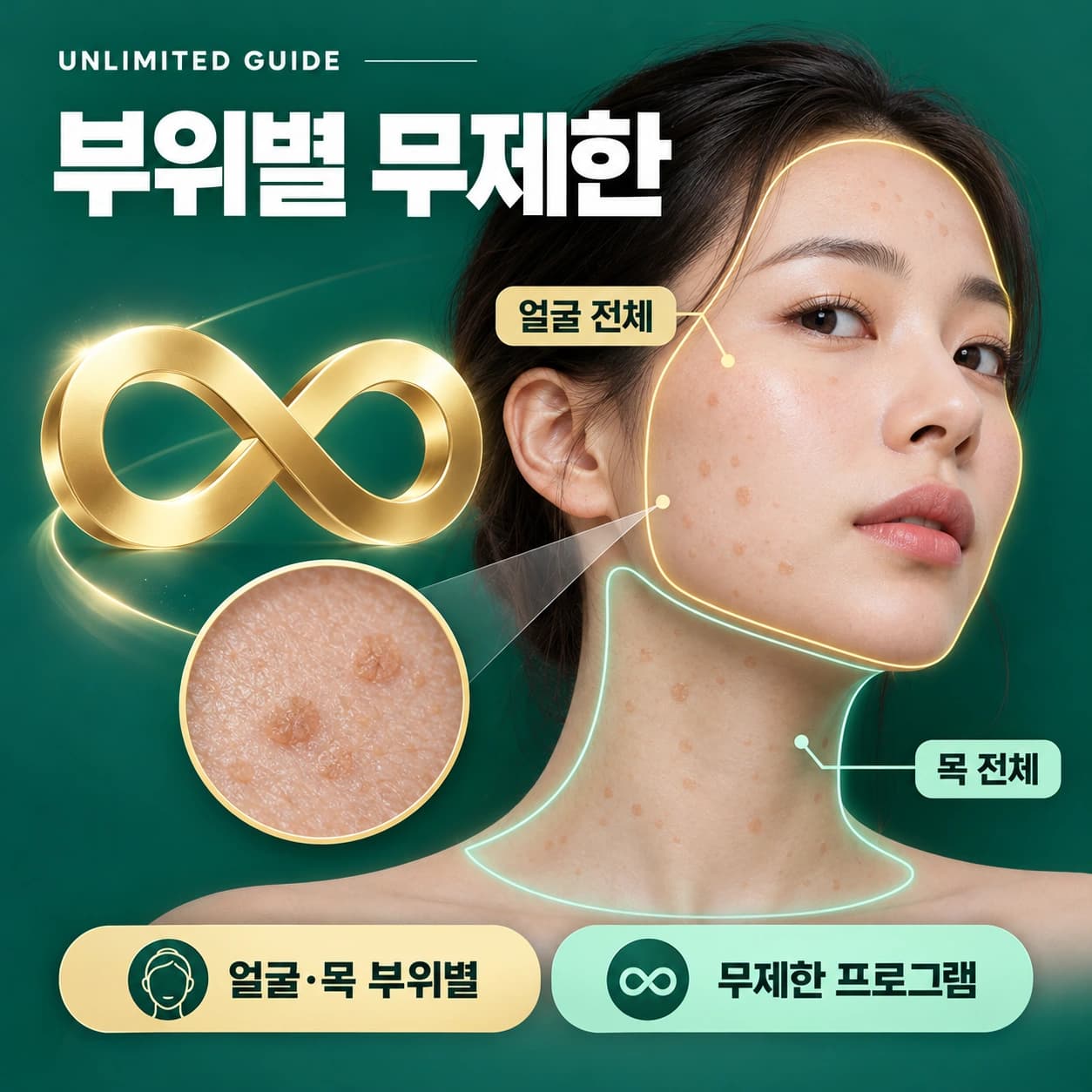 천안 편평사마귀 무제한