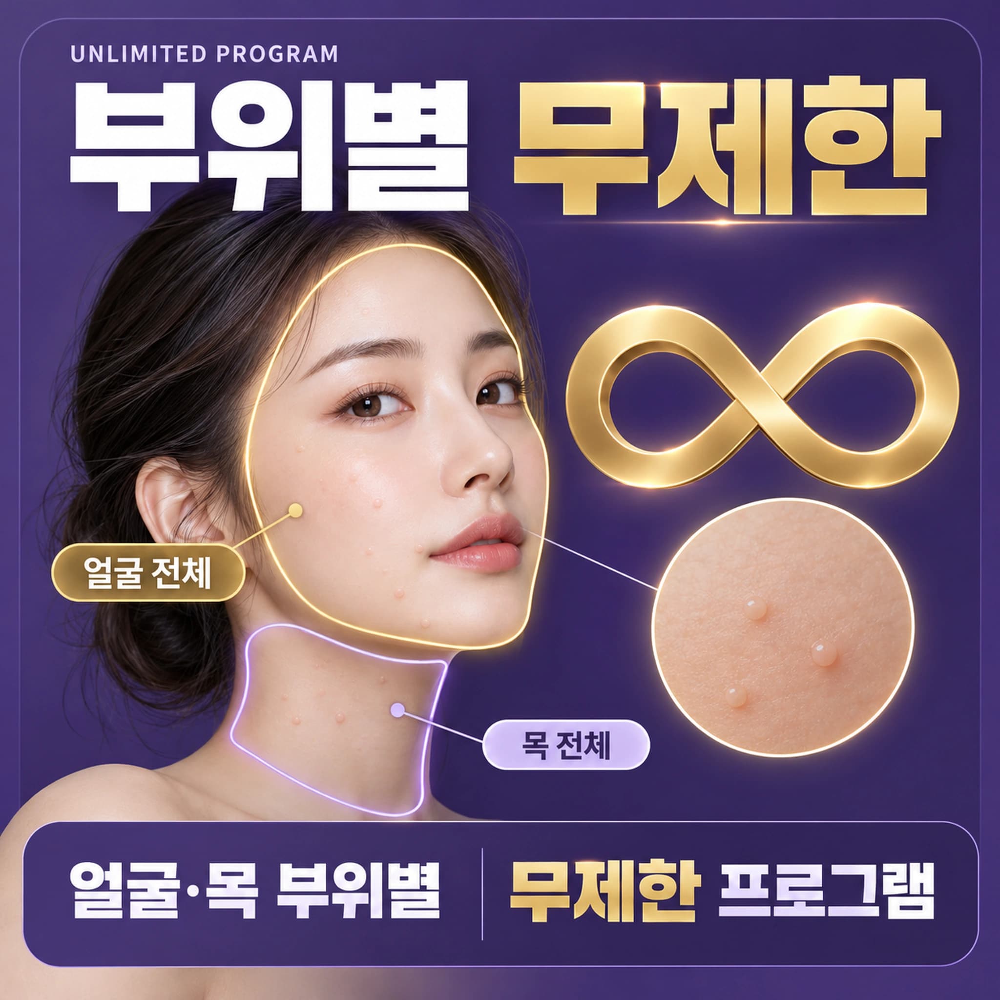 천안 편평사마귀 무제한