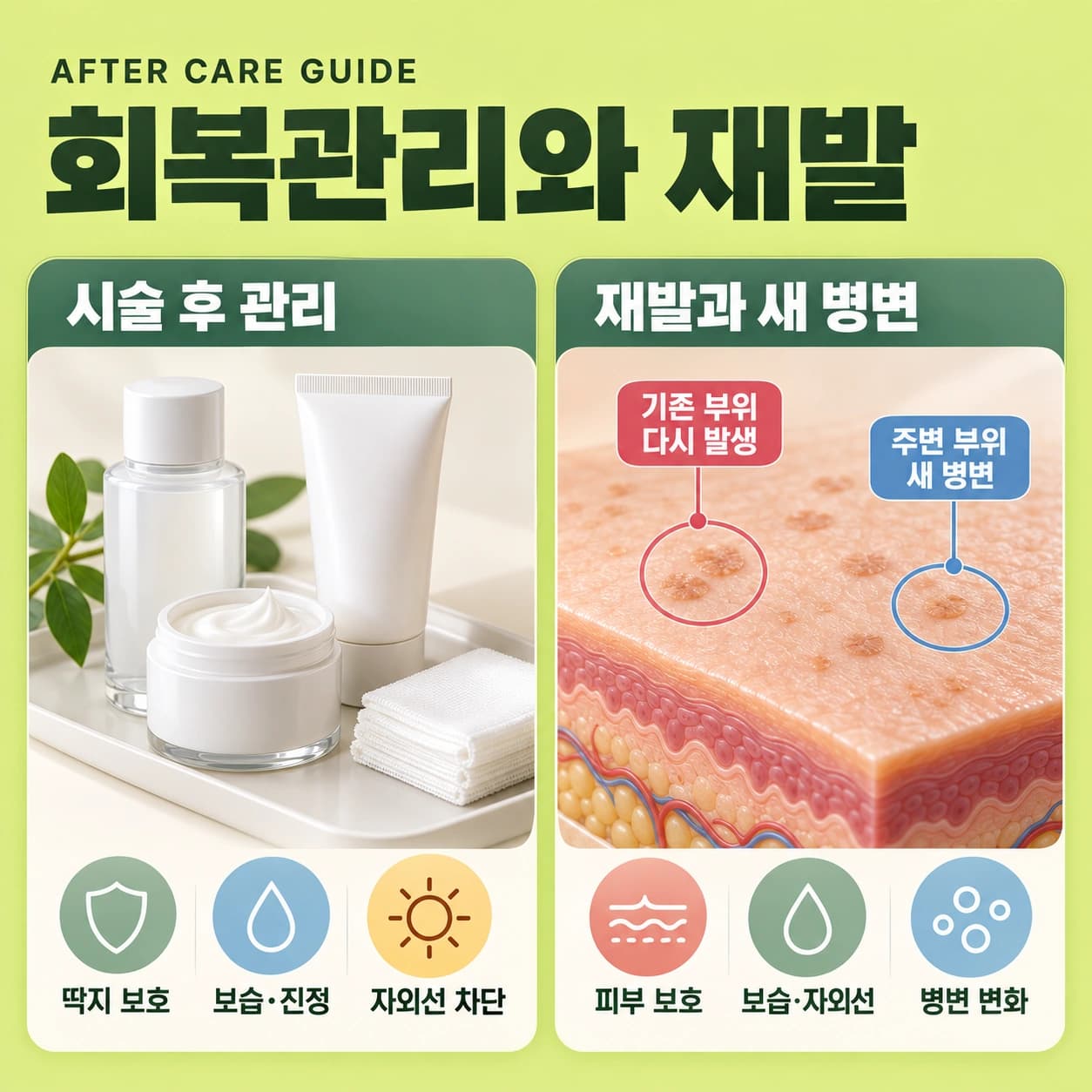 천안 편평사마귀 시술후 관리와 재발