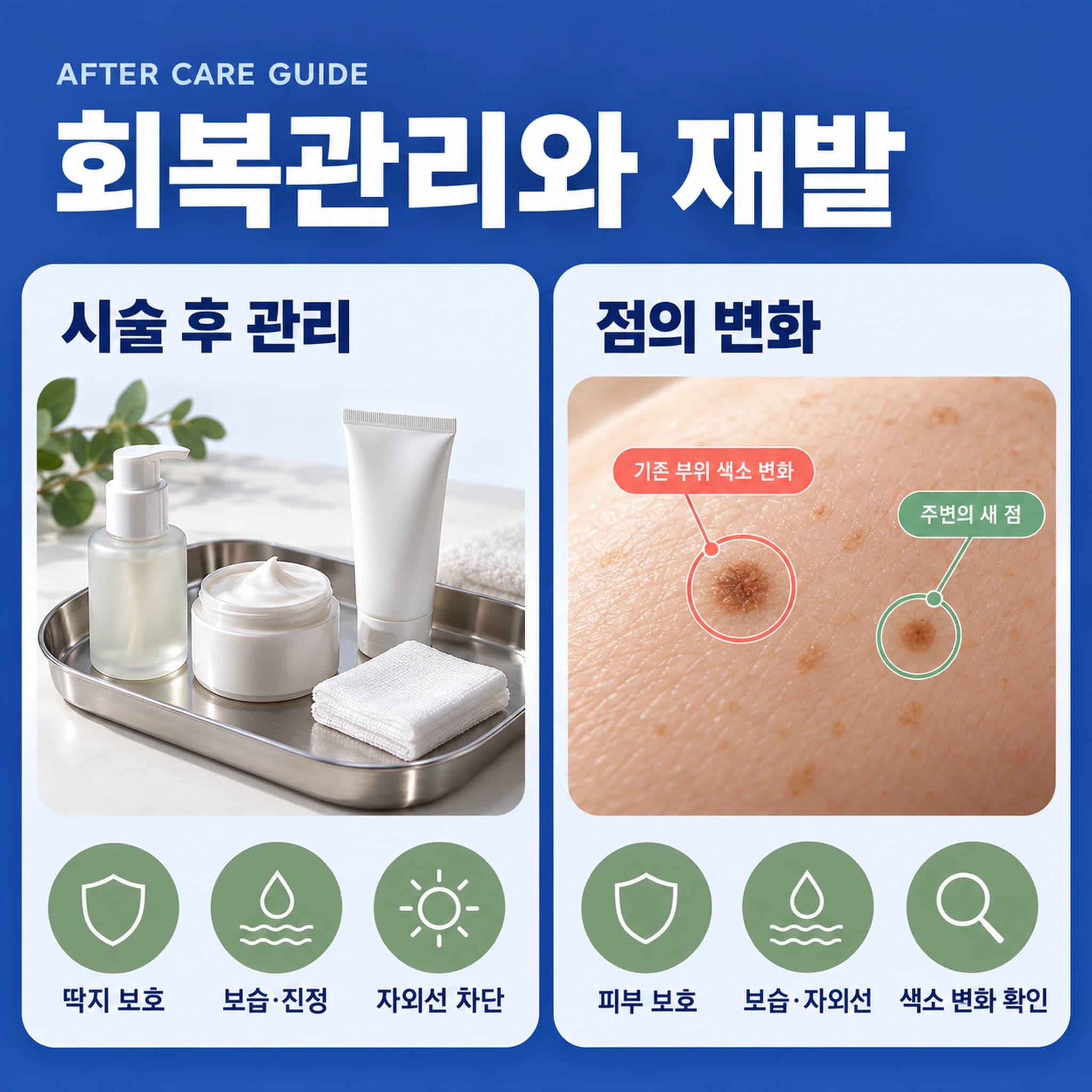 천안 점제거 시술 후 관리