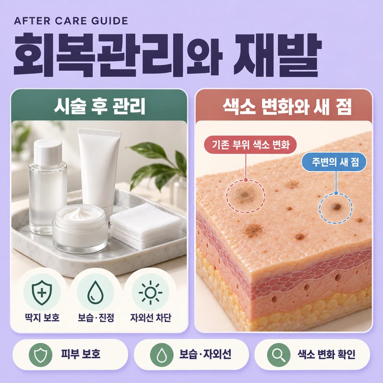 천안 점빼기 비용 시술 후 관리
