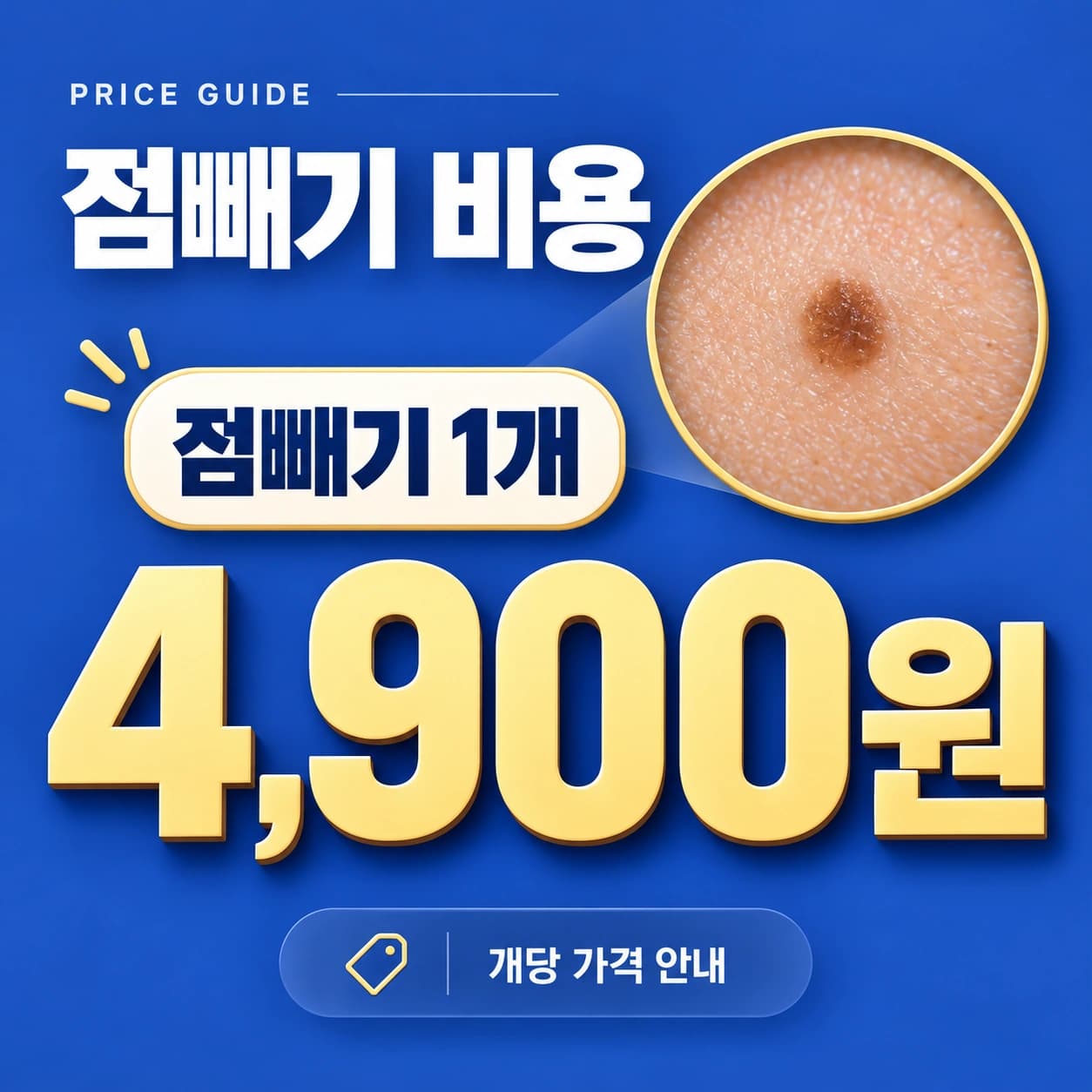 천안 점빼기 비용 비용