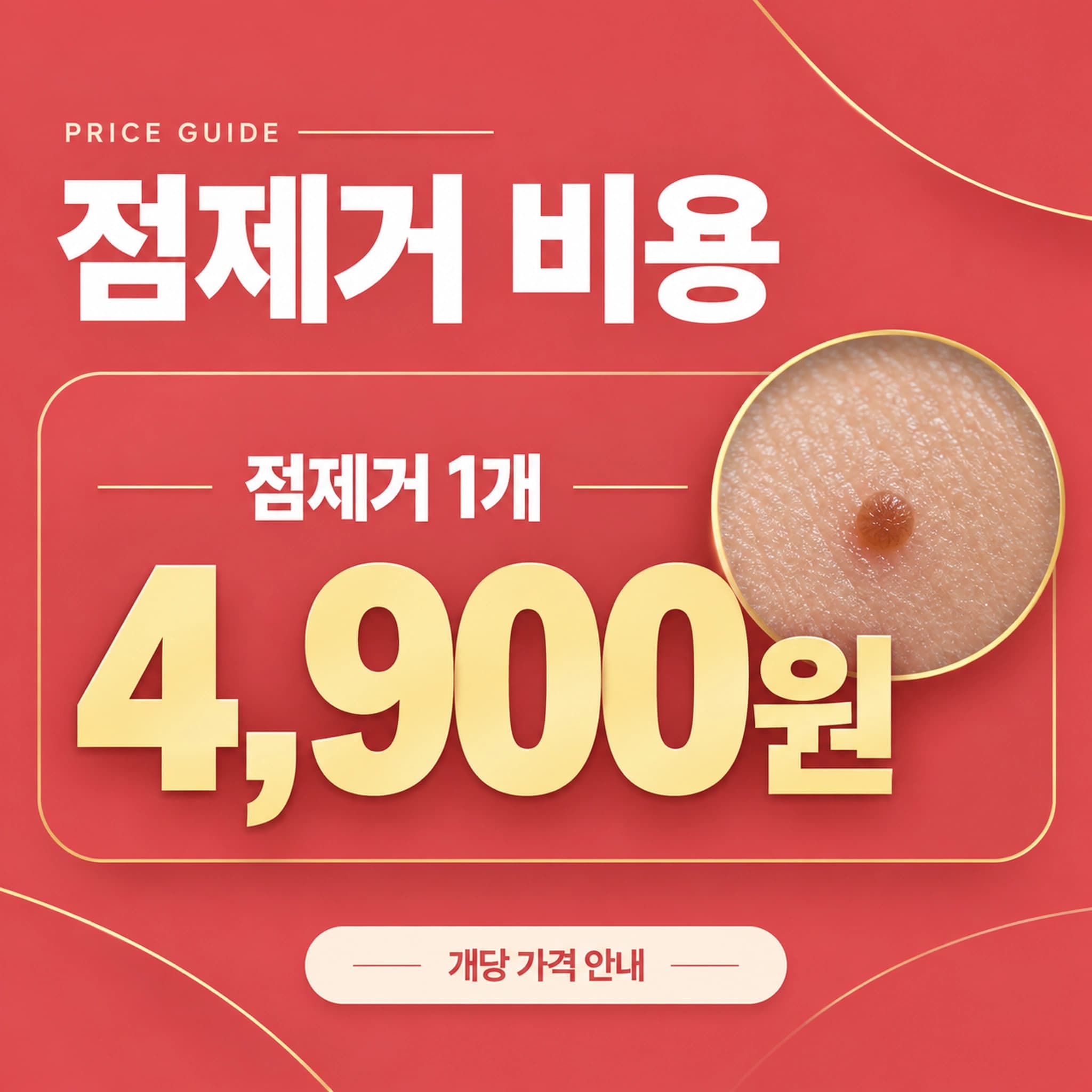 천안 점빼기 추천 비용