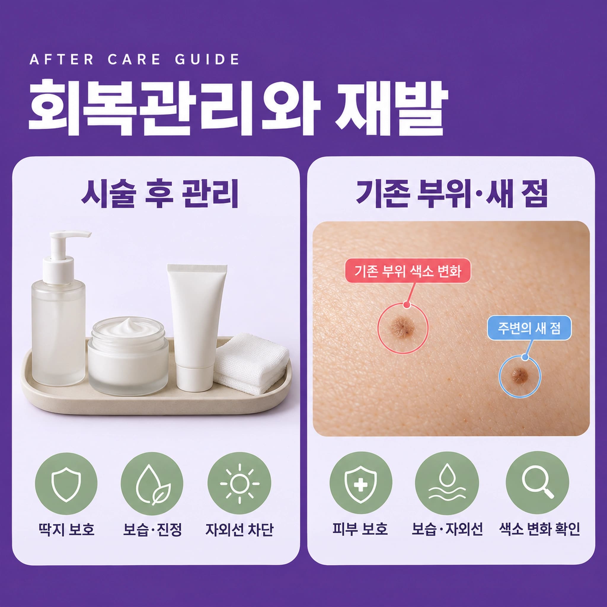 천안 점빼기 무제한 시술 후 관리