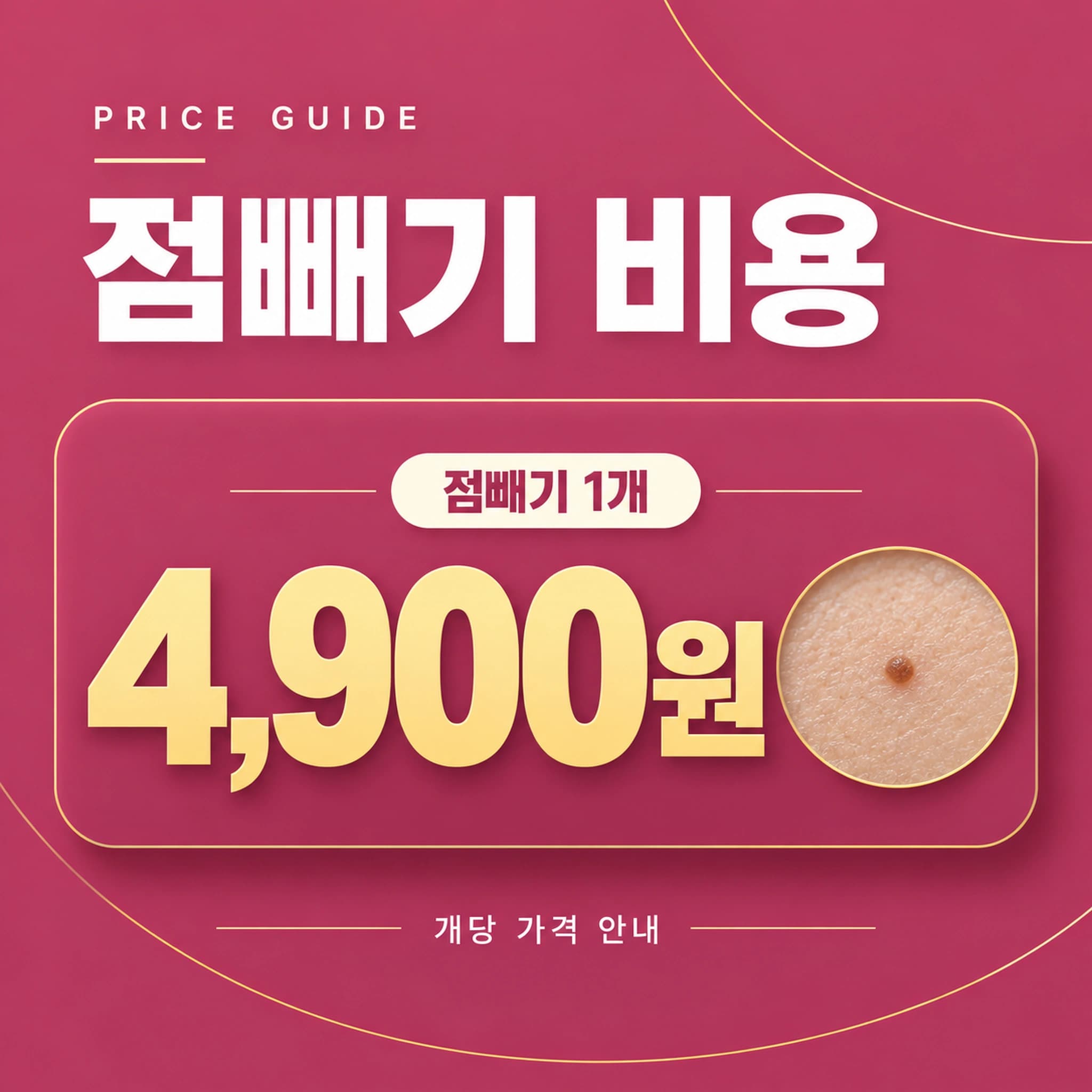 천안 점빼기 무제한 비용
