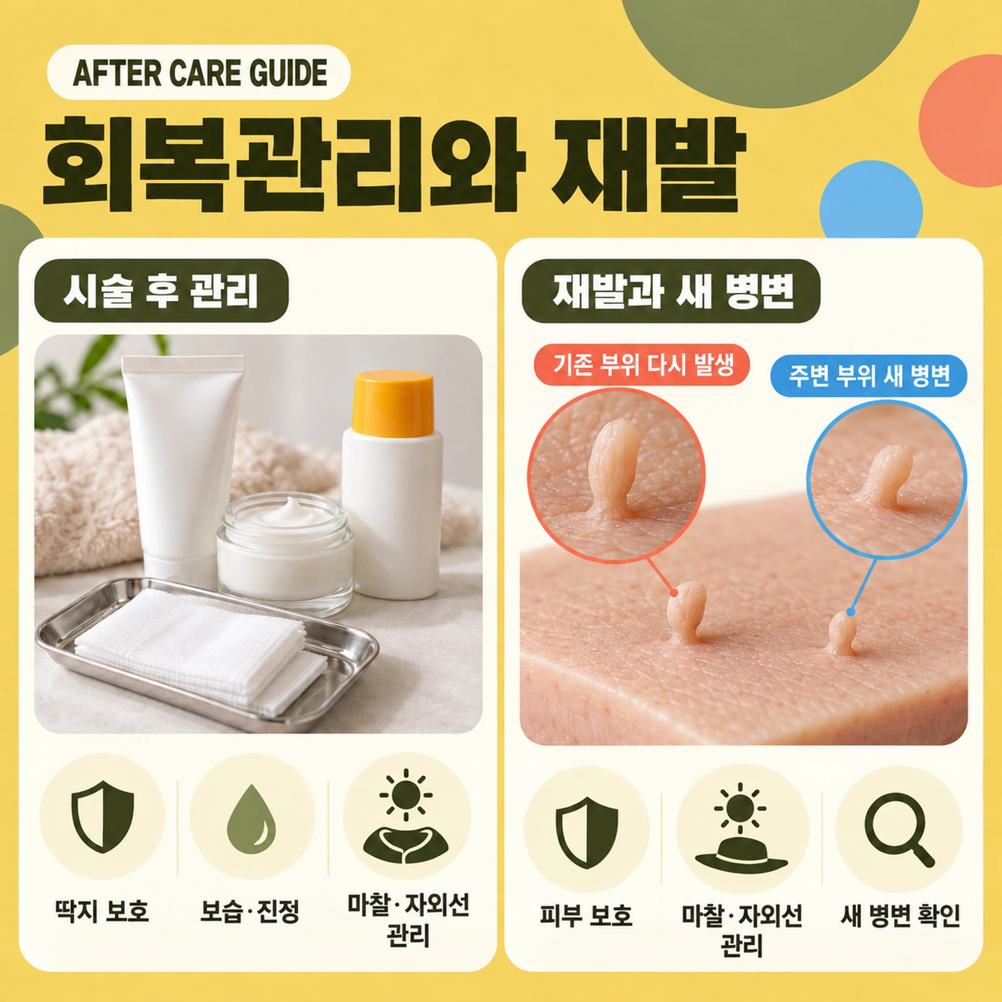 천안 쥐젖 제거 시술 후 관리