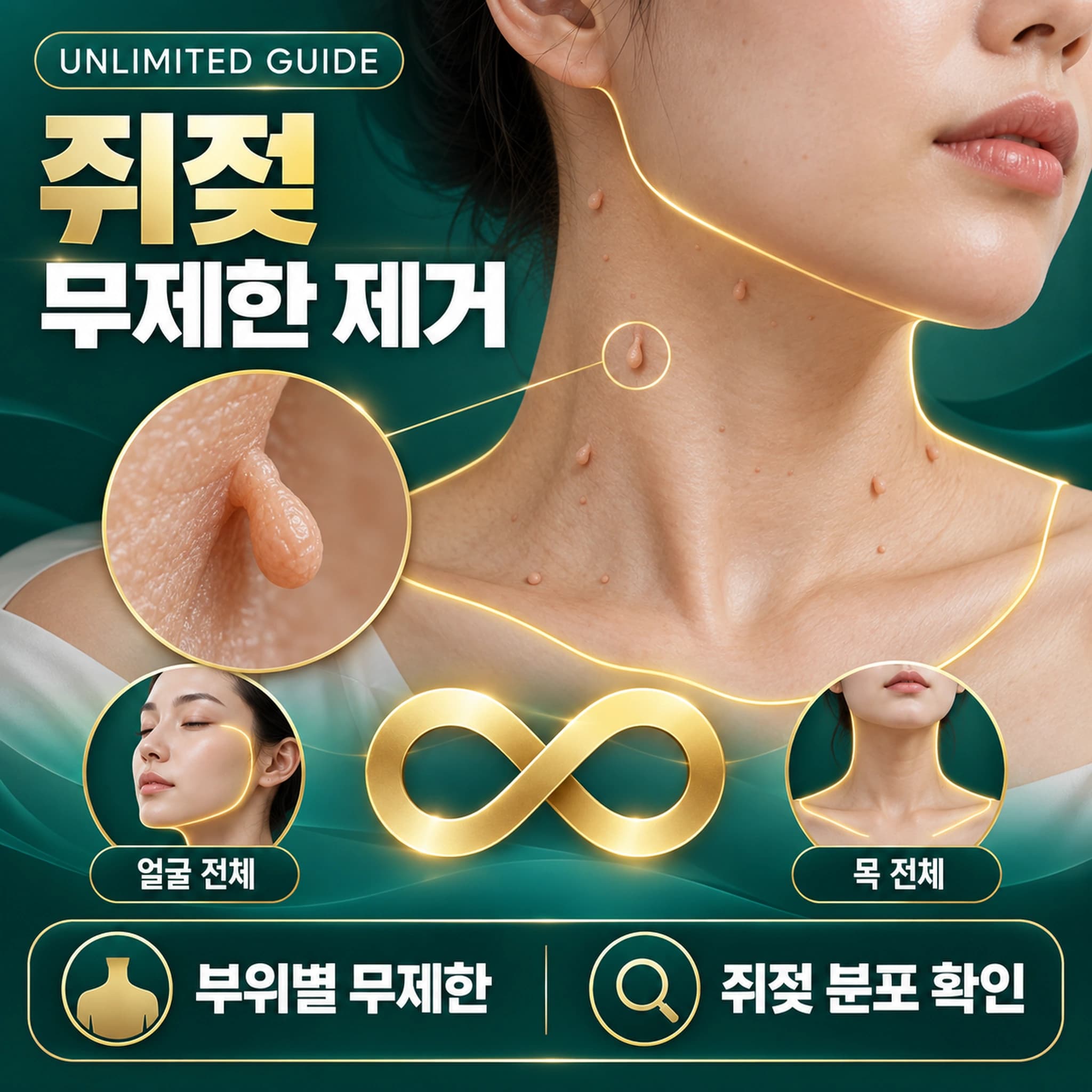 천안 쥐젖 제거 무제한