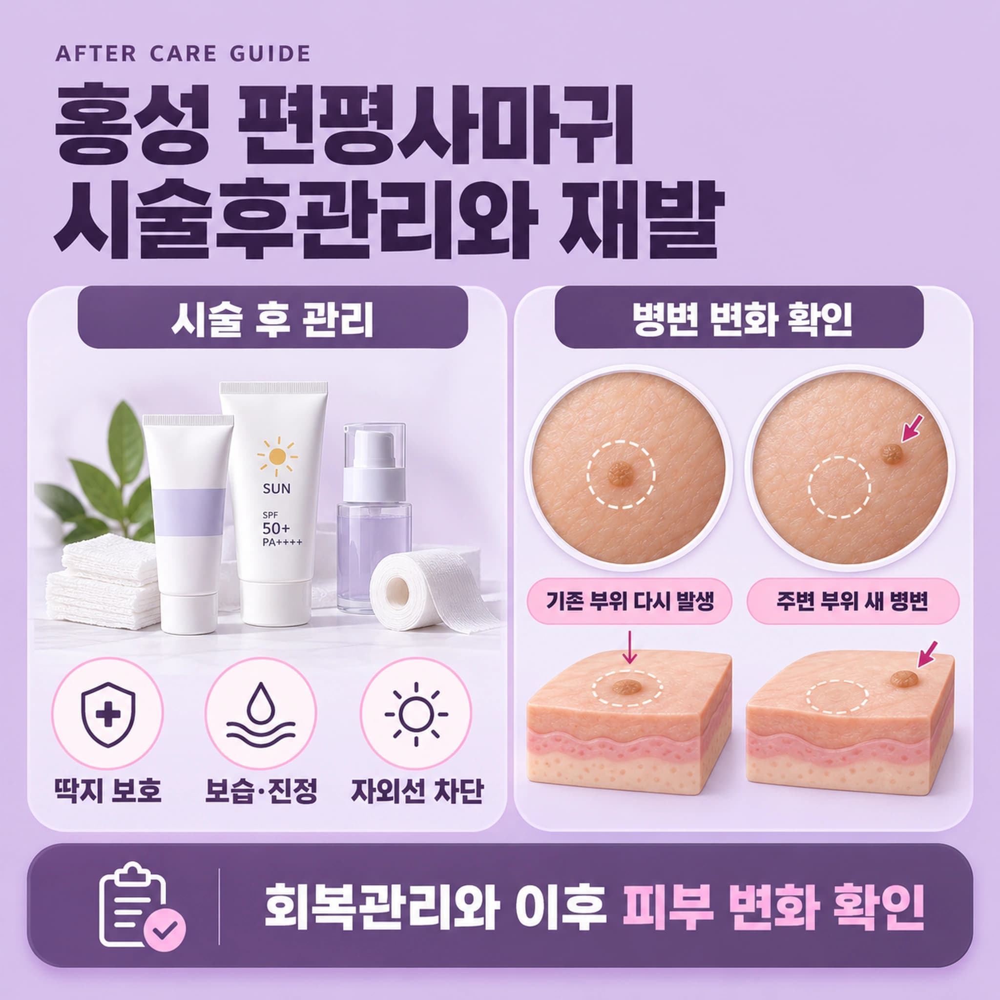 홍성 편평사마귀 시술후관리와 재발