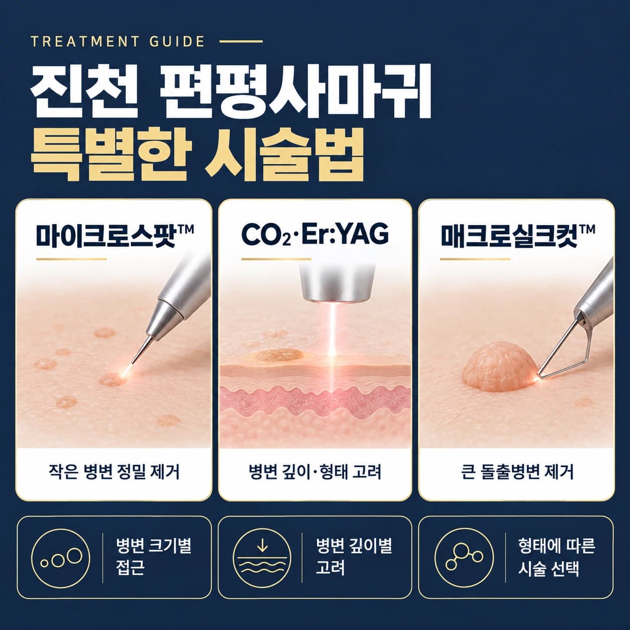 진천 편평사마귀 특별한 시술법