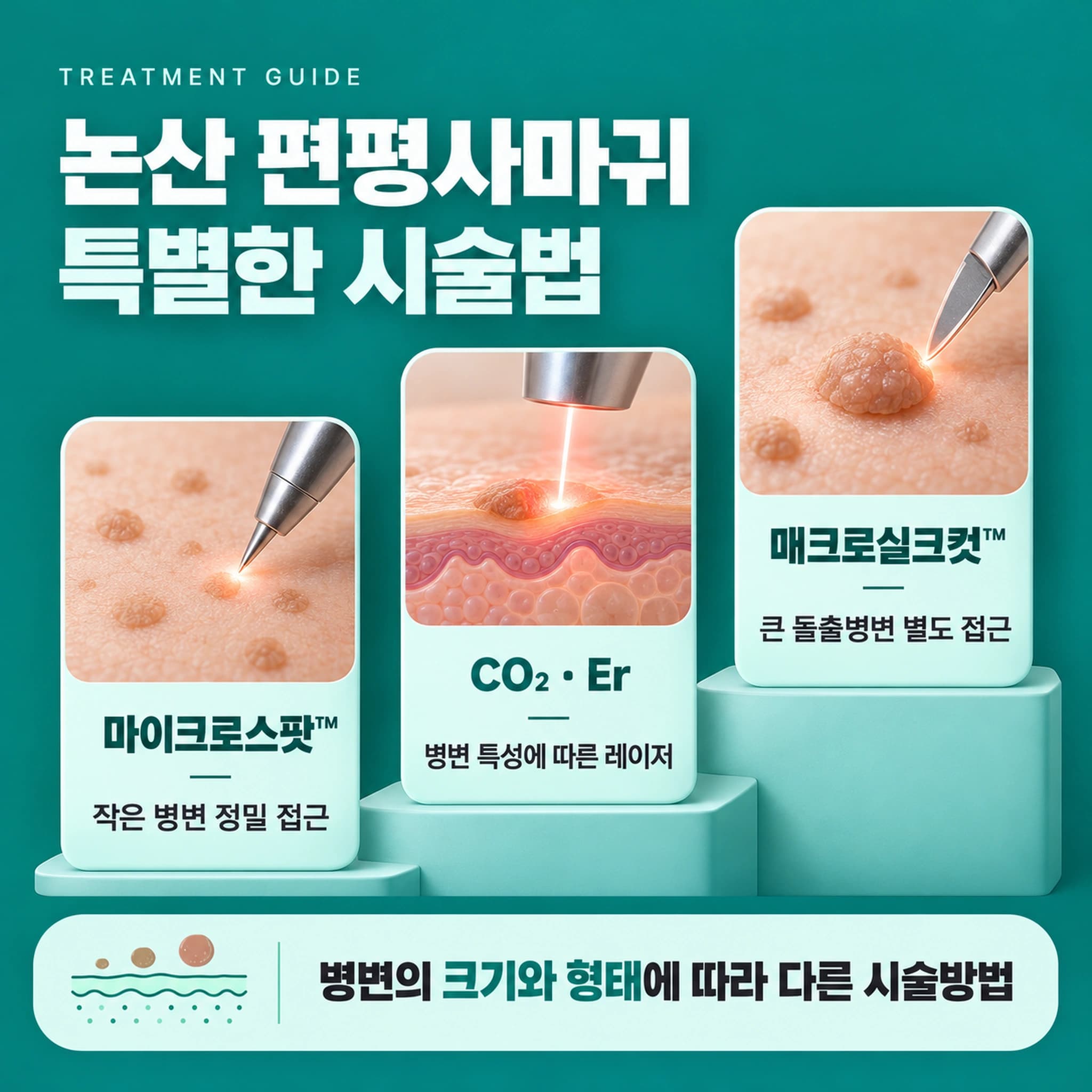 논산 편평사마귀 특별한 시술법