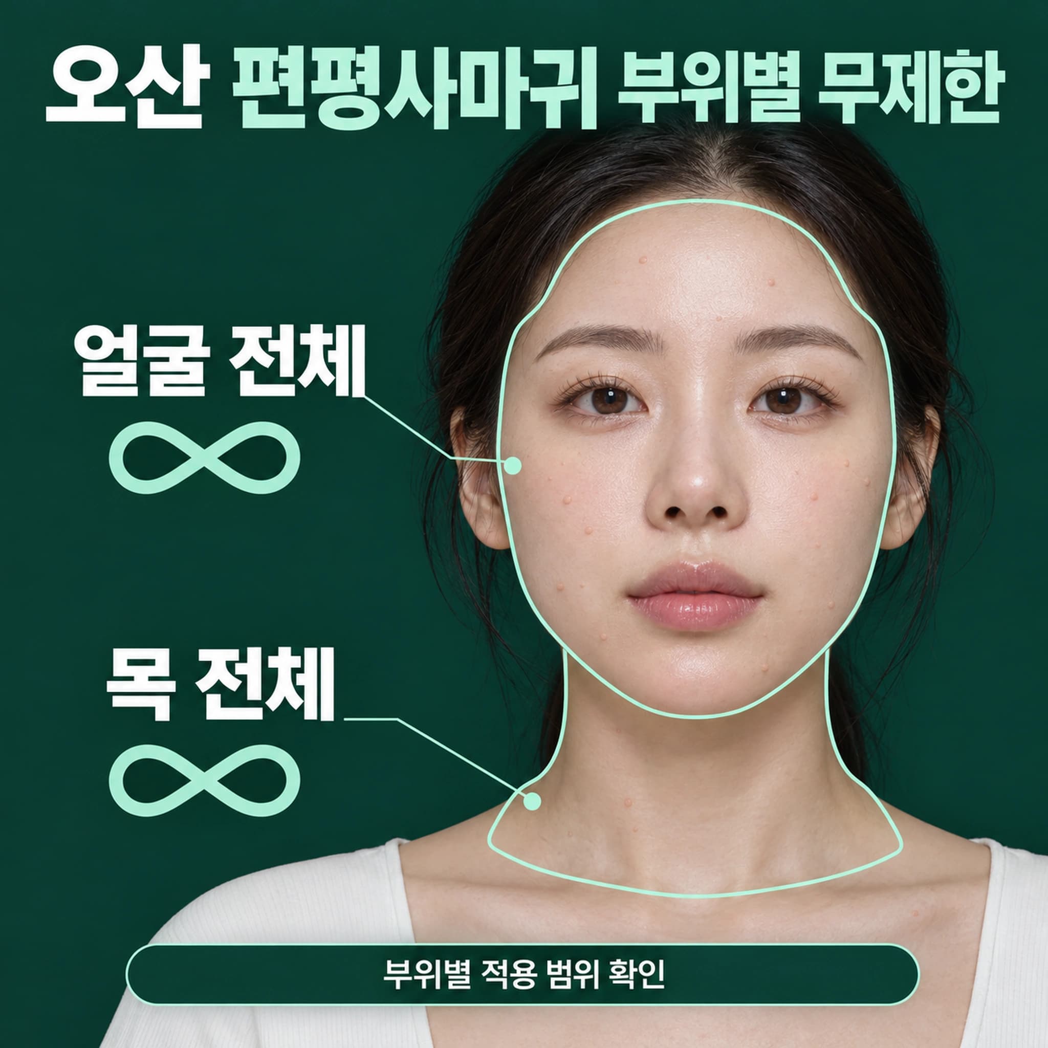 오산 편평사마귀 무제한