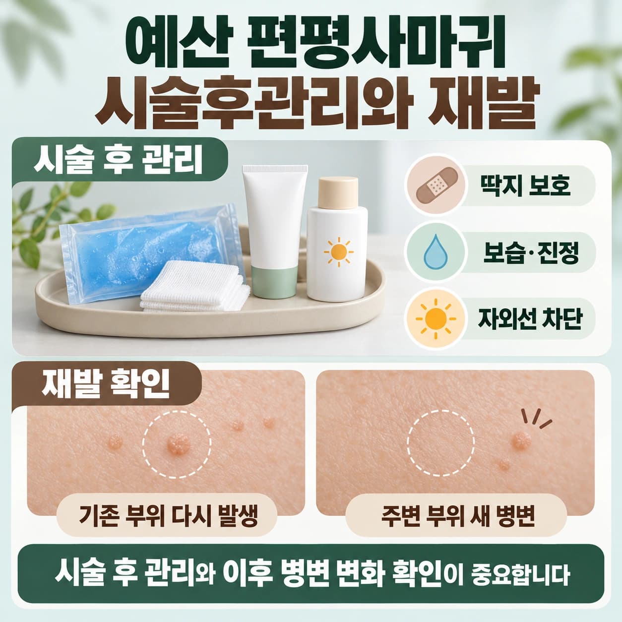 예산 편평사마귀 시술후관리와 재발